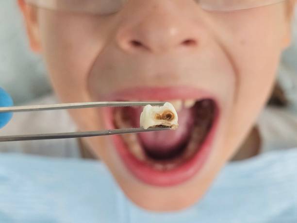 Best Broken Tooth Emergency  in Battle Creek, MI
